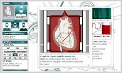 Heart Surgery  gameplay screenshot