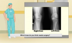 Virtual Knee Surgery  gameplay screenshot